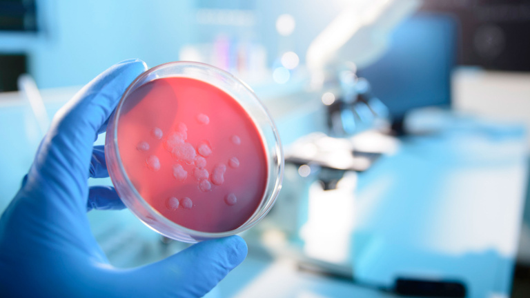 From gut microbiota research to startup: the MicThera journey