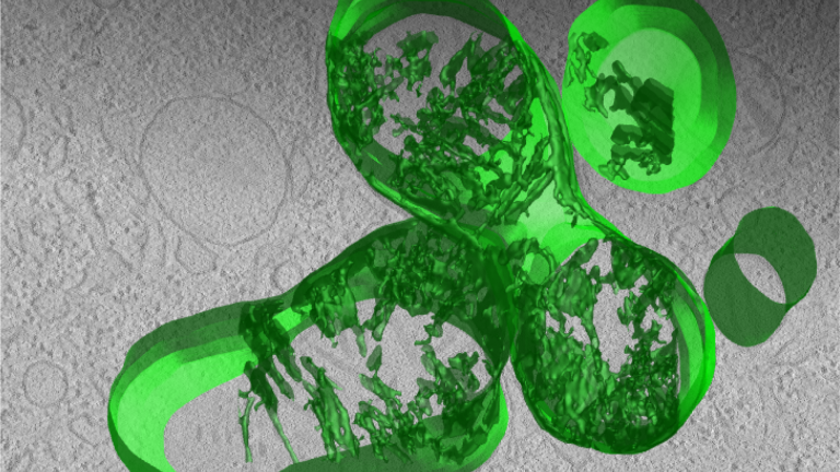 Electron Microscopy