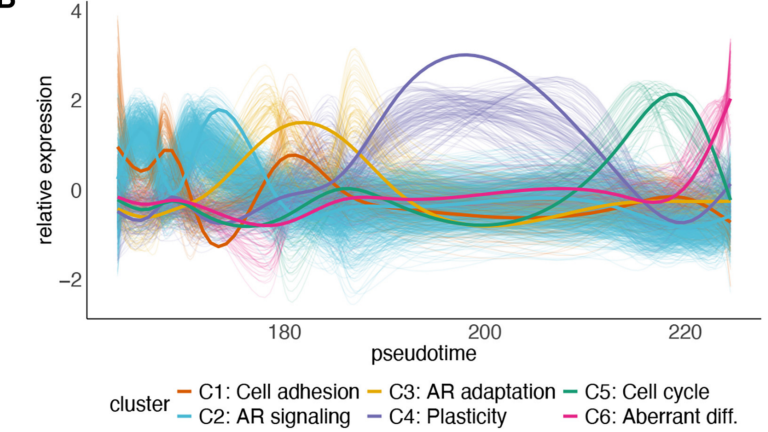 An integrated proteomic portrait of prostate cancer progression